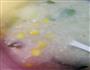 鱼片粥木有腥味的做法图解2