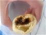 玫瑰的做法图解14