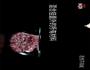 挂面丸子的做法图解2