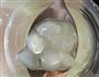 银耳皂角米红枣枸杞莲子汤的做法图解1